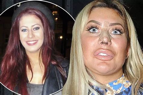 chloe ferry fake|chloe ferry eye surgery.